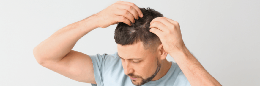 Guy checking hairline