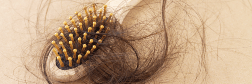 hair loss forum advice