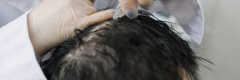 topical-hair-loss