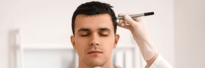 Guy getting hairline looked at