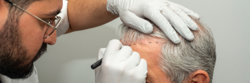 man's head being drawn on