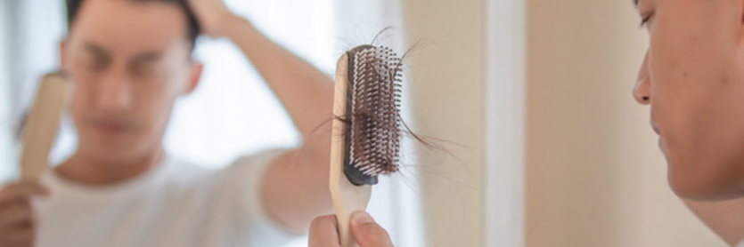 Hair Loss