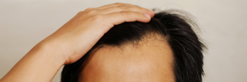 man touching his head