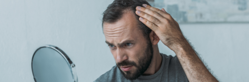 guy checking for hair loss