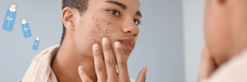 man checking if he has acne