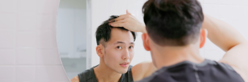 Man hair loss