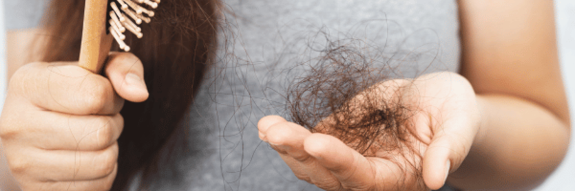 woman holding shedding hair