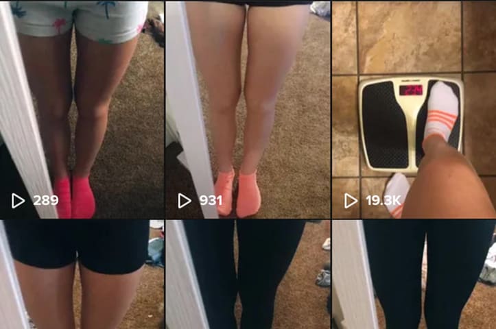 TikTok’s “For You” Algorithm Exposed Young Users to Pro-Eating Disorder Content