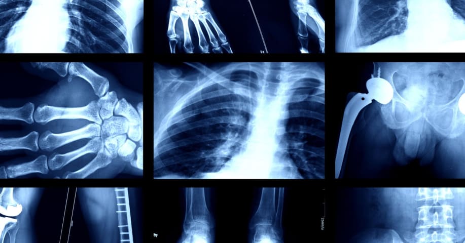 These Algorithms Look at X-Rays-and Somehow Detect Your Race