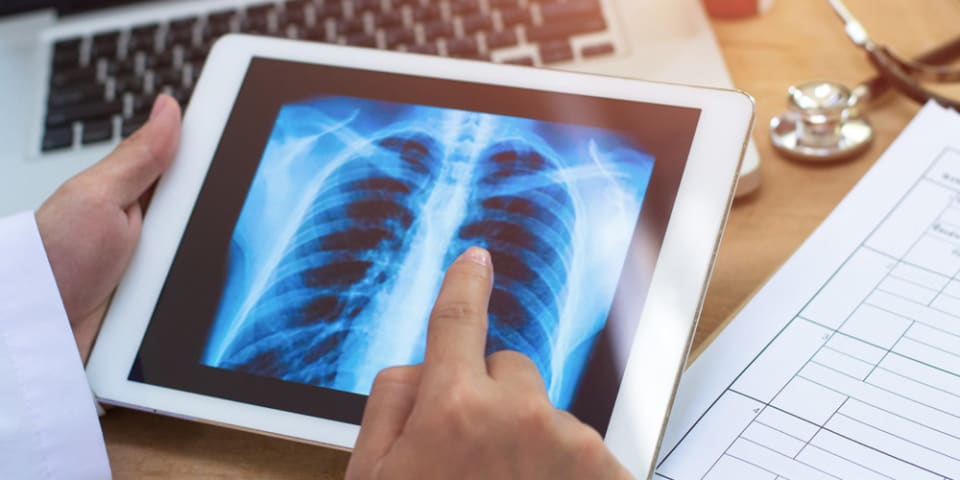 Researchers find evidence of racial, gender, and socioeconomic bias in chest X-ray classifiers