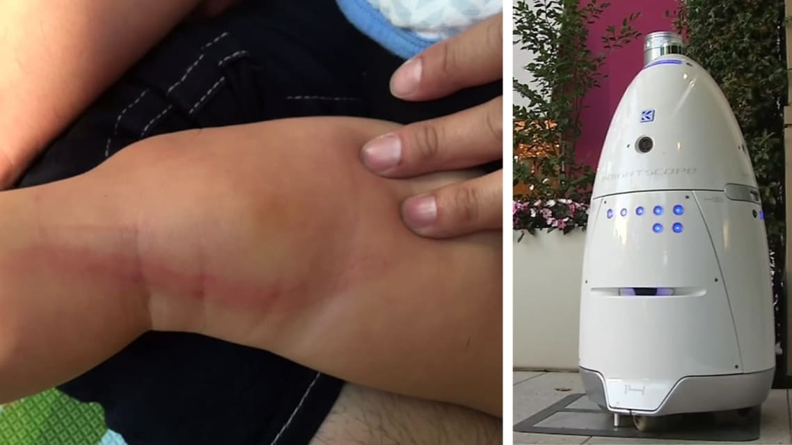 Parents upset after Stanford Shopping Center security robot injures child