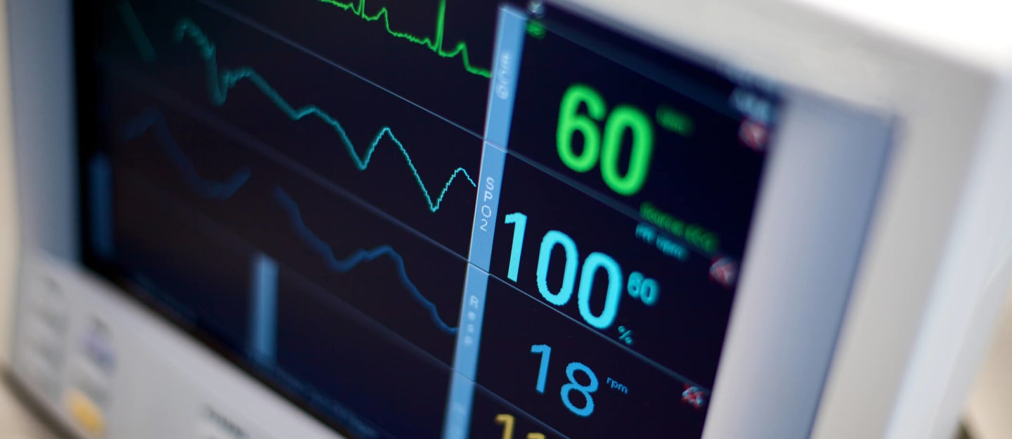 Understanding Electrocardiography (ECG) Unveiling the Heart's