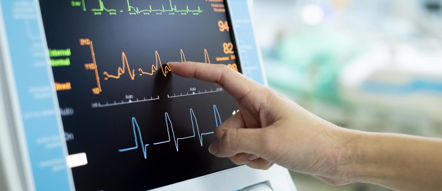 The Significance of ECG in Healthcare Screening