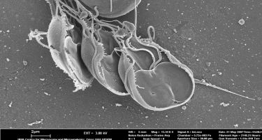 At this stage the Giardia parasite multiplies in the small intestine and sticks to the gut wall
. Credit: Peta Clode, UWA