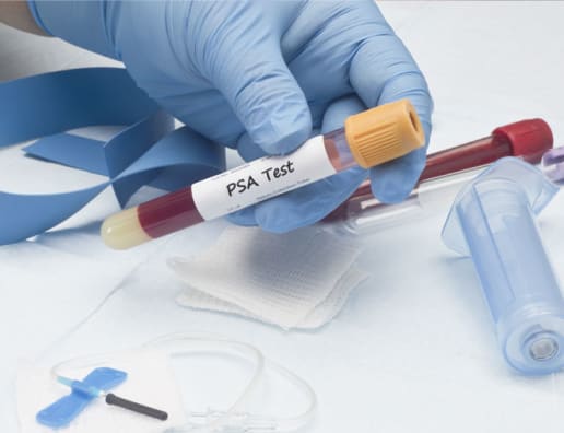 Screening and Early Detection