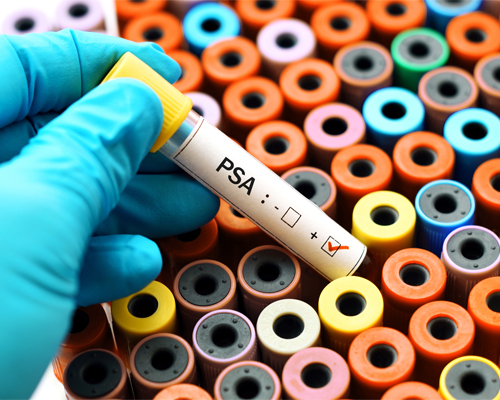 Prostate Cancer Foundation