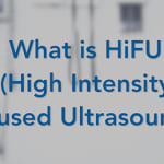 What is HIFU?