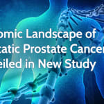 Genomic Landscape of Metastatic Prostate Cancer Unveiled in New Study