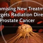 Clinical trial finds strong promise for new treatment that targets radiation directly to prostate cancer