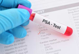 PSA Test