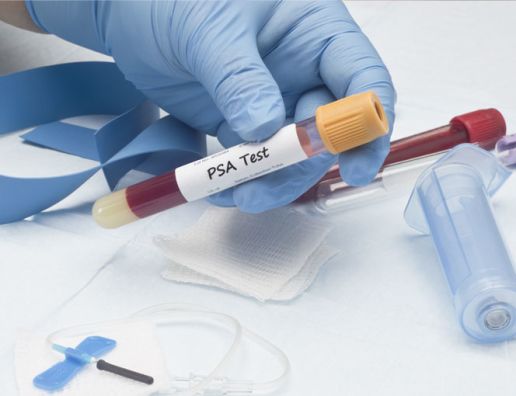 Screening and Early Detection