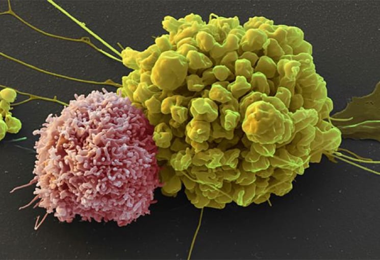 NK cell (pink) attacking tumor cell (green). Sources: Nature (Credit: Eye of science/SPL)