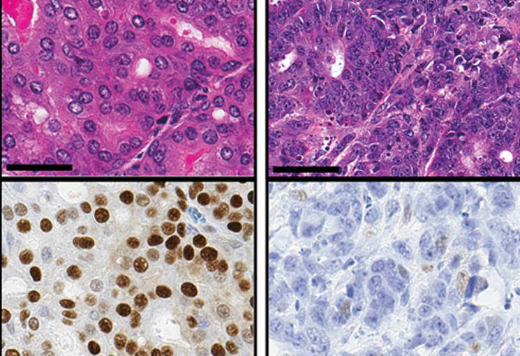 Photomicrograph images of a tumor region