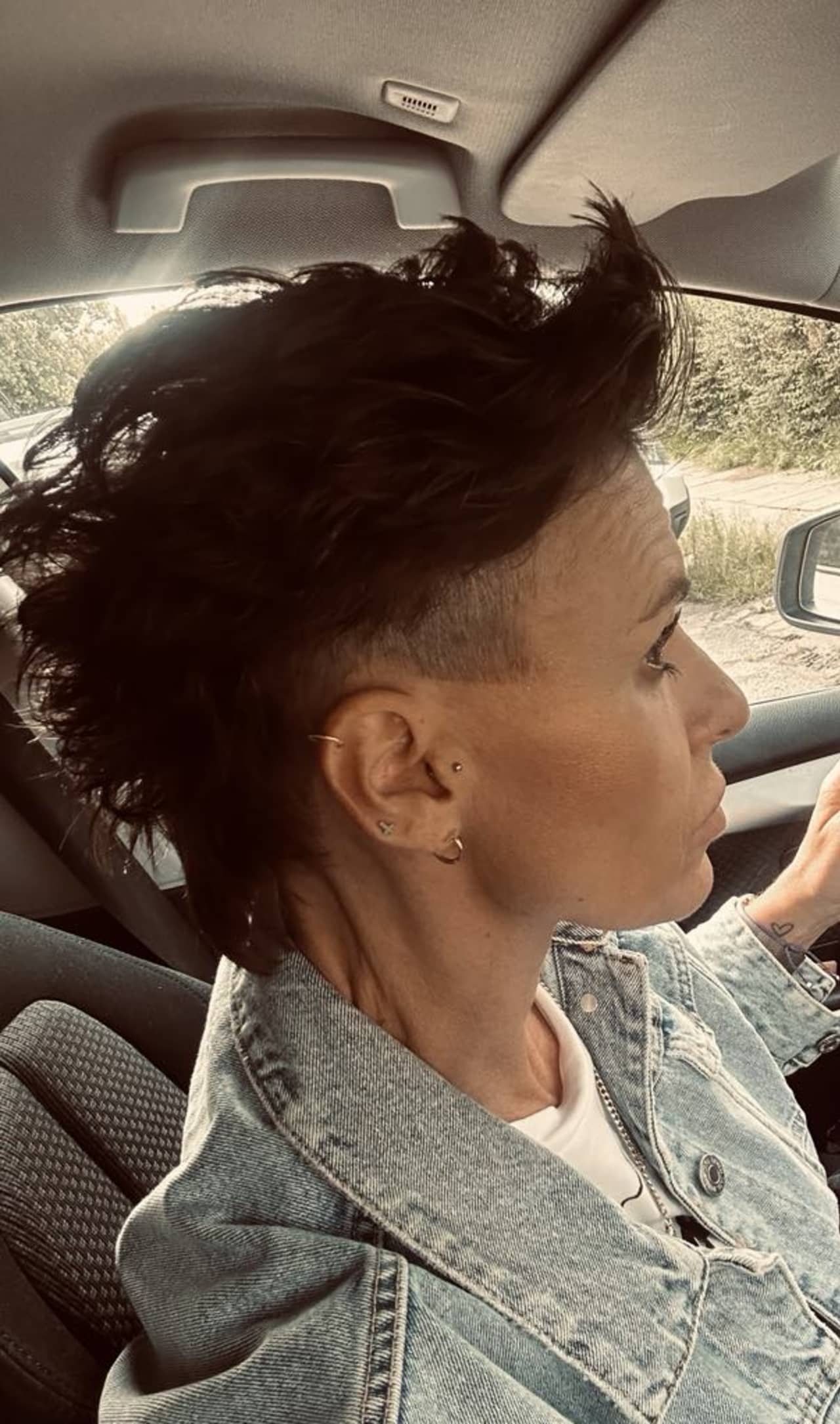 vk-alopecie