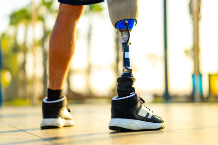 Disabled young woman with prosthetic leg standing in front of a