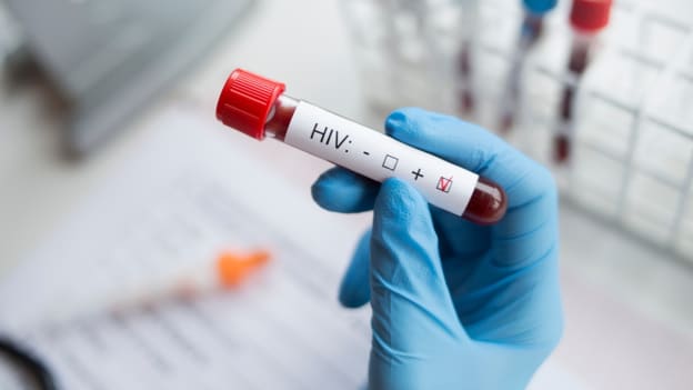 High Court warns employers: You cannot fire a worker for being HIV positive High Court warns employers: You cannot fire a worker for being HIV positive
