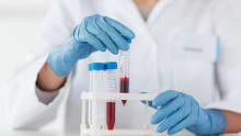 Rising demand for phlebotomists in India’s healthcare sector