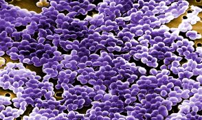 INFECCIONES Y ANTIBIOTICOTERAPIA EN PACIENTES CRÍTICOS - PerfectMED
