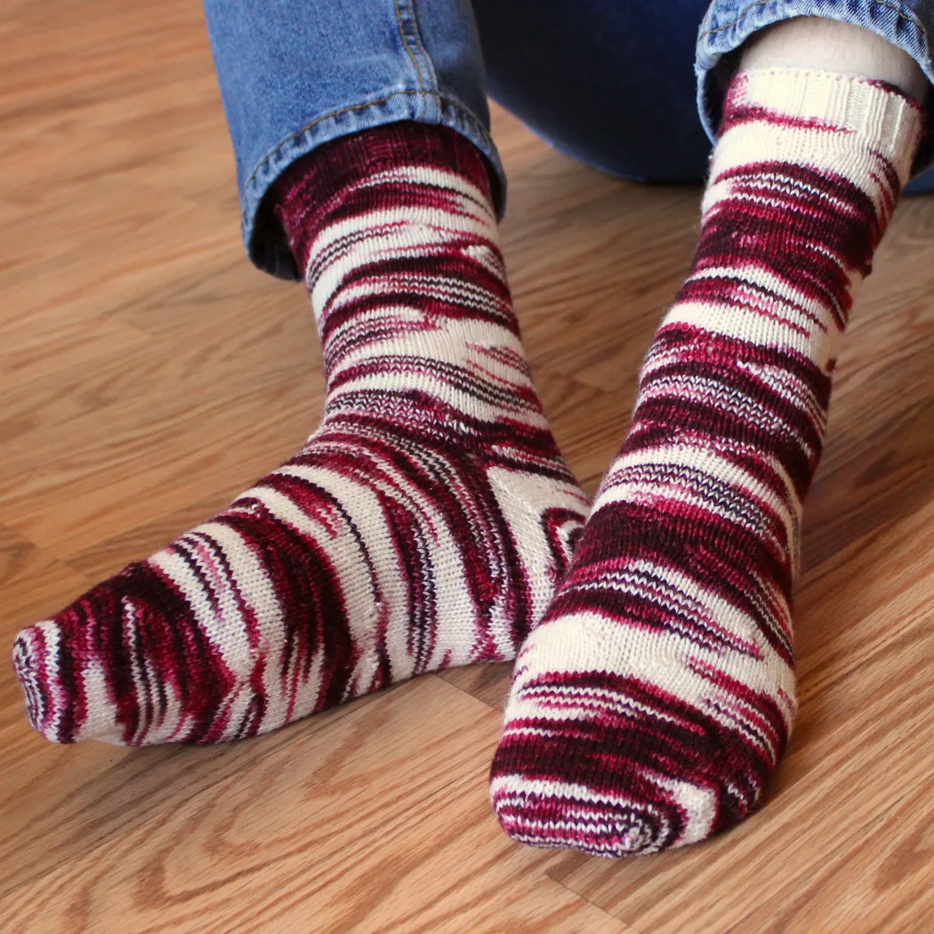 Front and underside view of feet wearing red and white socks with distorted, oval-shaped pooling patterns