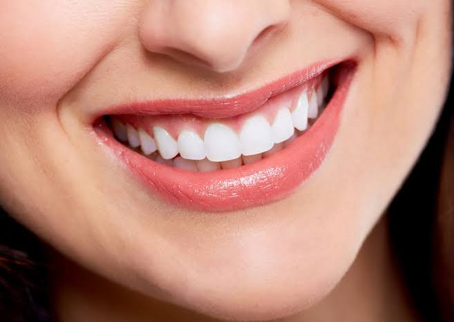 Smile Makeover in Indore — Cost, Treatments & Before/After Results (2026)
