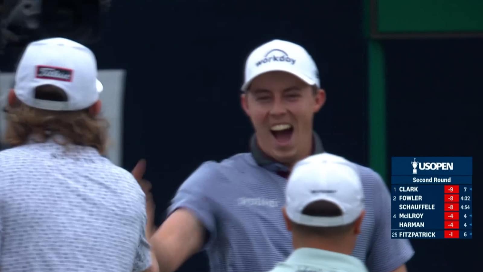 Matt Fitzpatrick’s shocking ace at U.S. Open