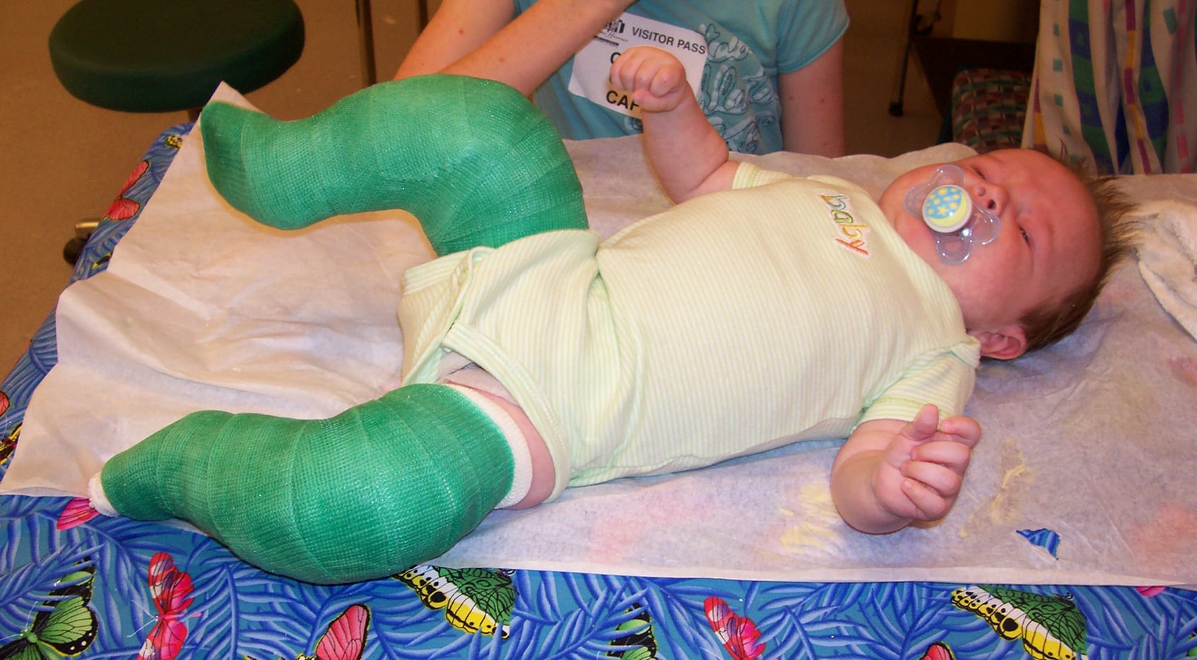 After several months of weekly cast changes, Keoni was able to go four weeks between casts. (Kathy Holmes)