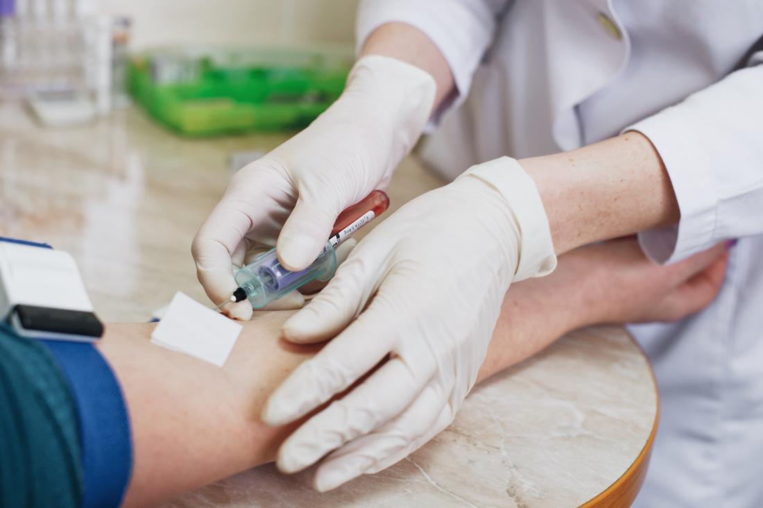 Blood Tests Find A Provider Near You