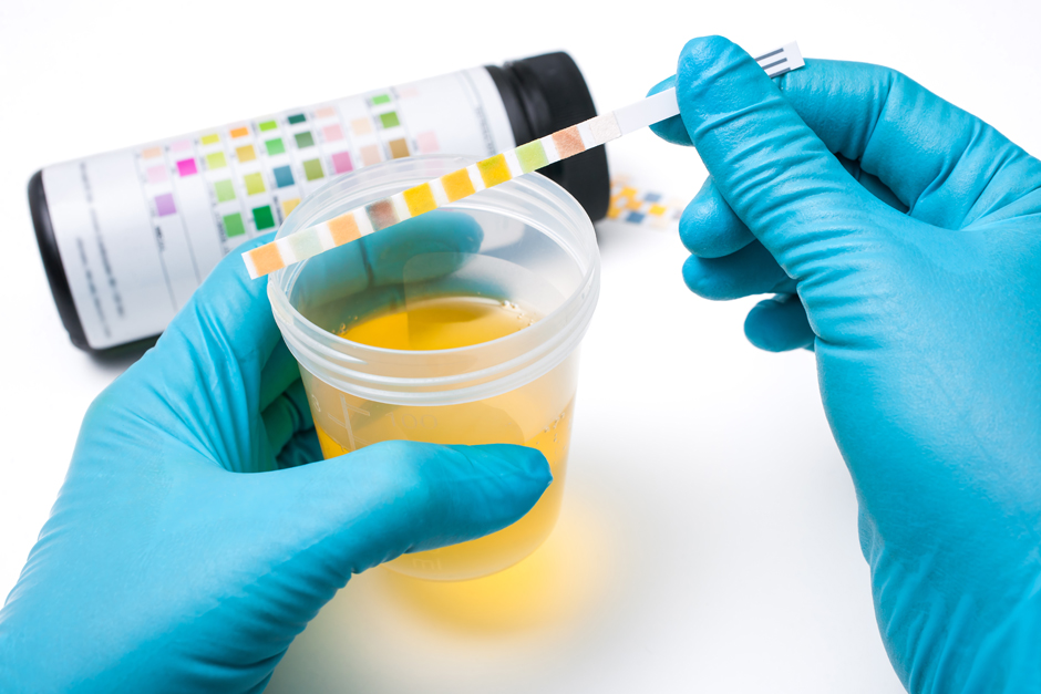 Urine testing sample photo.