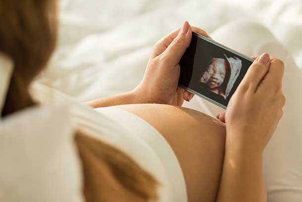 4D Ultrasound Scan image