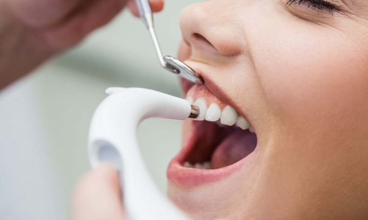 Dental scale and polish at the dental hygienist