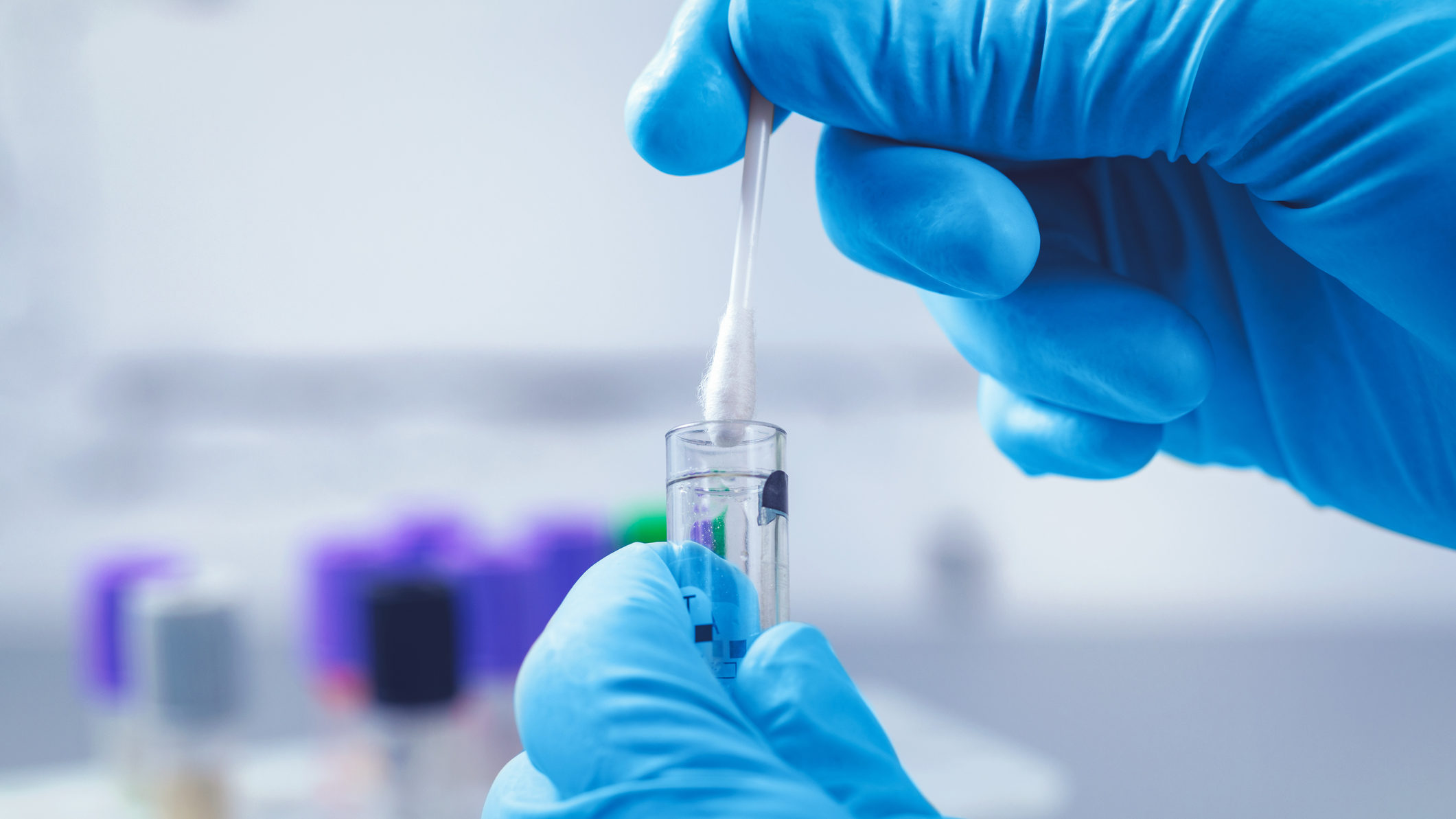 Non-invasive prenatal testing (NIPT) lab work