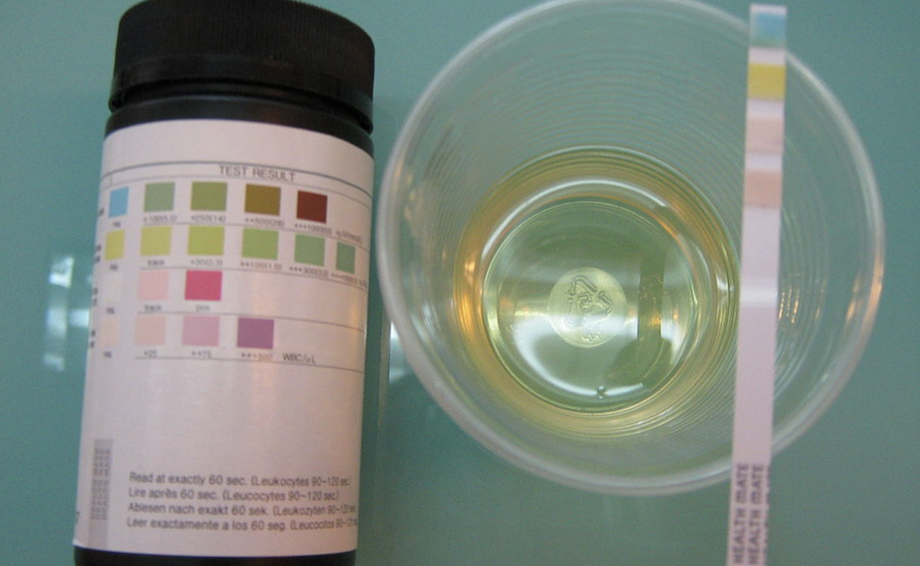 Urine testing sample photo.