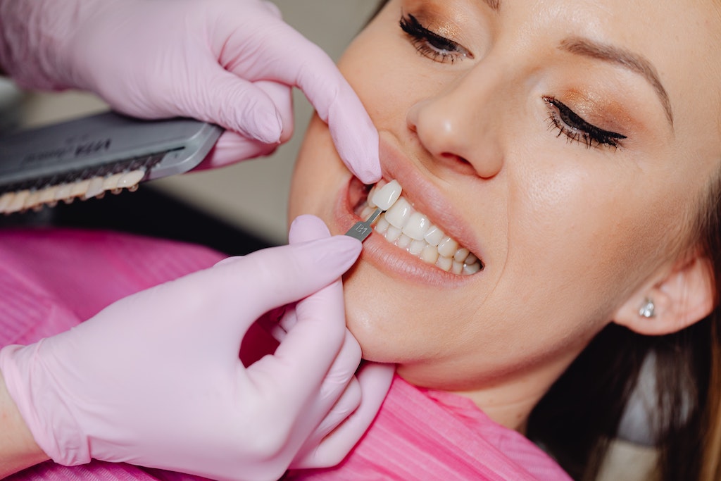 Dental veneer - Photo by Karolina Grabowsa on Pexels.com