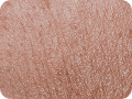 Medi Facial