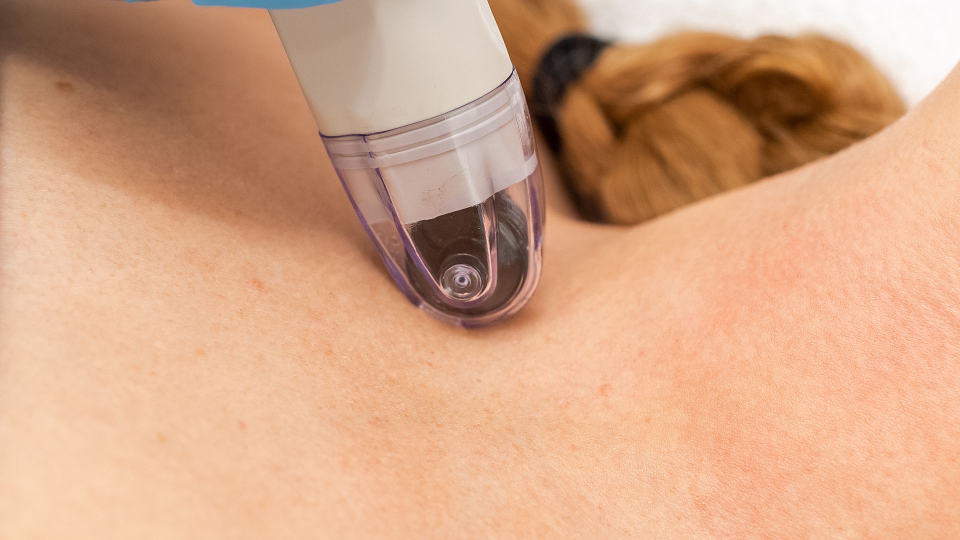 Dermagenesis Infusion slide 2