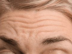 Forehead