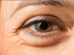 Eyelids