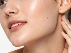 Jawline