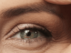 Around eyes