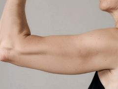ARMS